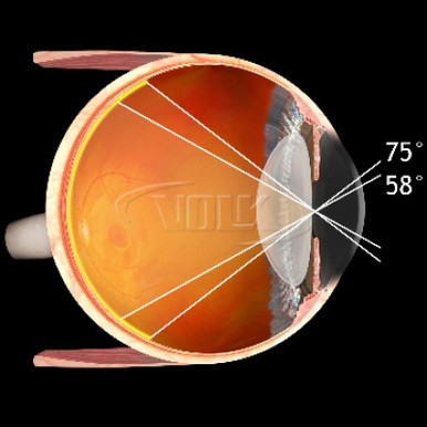 Volk 30D Small Aspheric Lens, Clear (31mm), with Black Ring, view 2