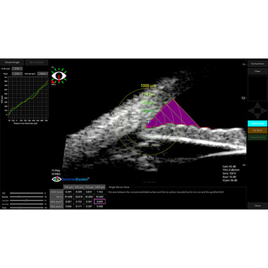 Sonomed VuPad Portable Ultrasound, view 8