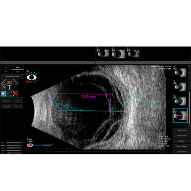 Sonomed VuPad Portable Ultrasound, view 7