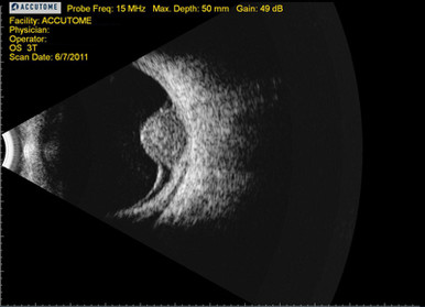 Keeler B-Scan Plus, view 8
