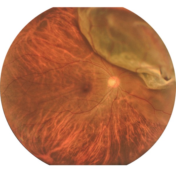 Marco Reticam 3100 Plus Ultra-Widefield Fundus Camera, view 5