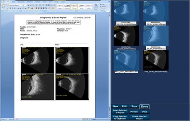 Keeler B-Scan Plus, view 7