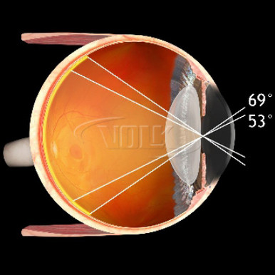 Volk 28D Large Aspheric Lens, Clear, with Green Ring, view 2