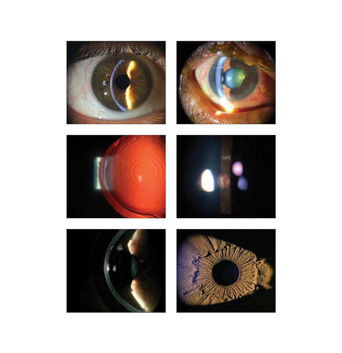 Marco Ultra M3 Slit Lamp, view 6