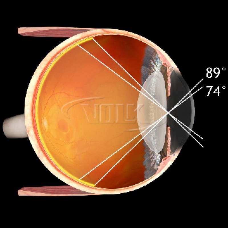 Volk 90D Small Aspheric Lens, Clear (21.5mm), with Black Ring, view 2
