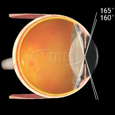 Volk H-R Wide Field Lens