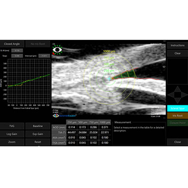 Sonomed VuMAX HD Ultrasound, view 4