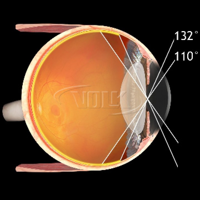 Volk VTE TransEquator Fundus Laser Lens, with Black Ring, view 3