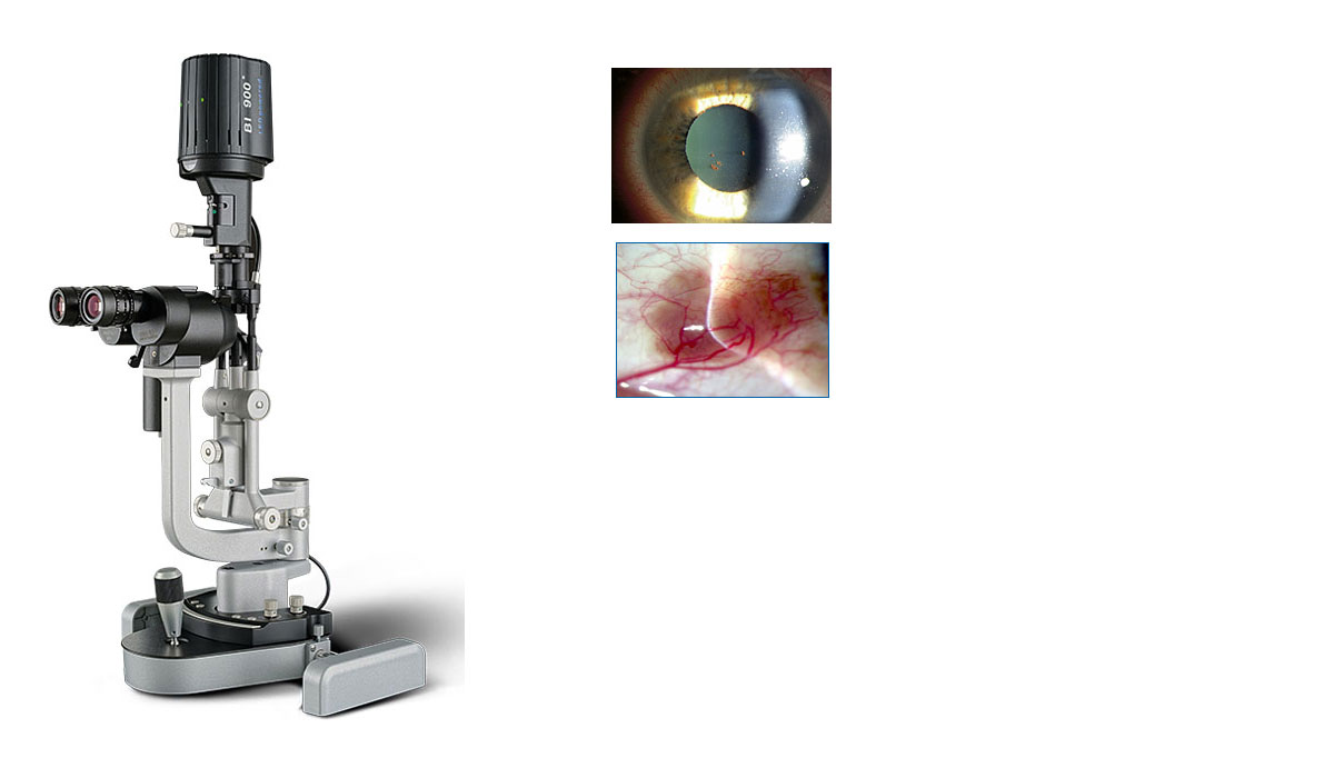 Haag-Streit BI 900 LED Slit Lamp, view 3