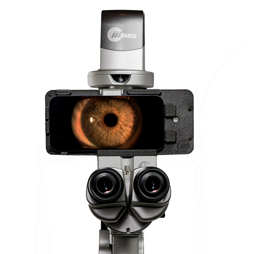 Marco iON 2 Imaging System