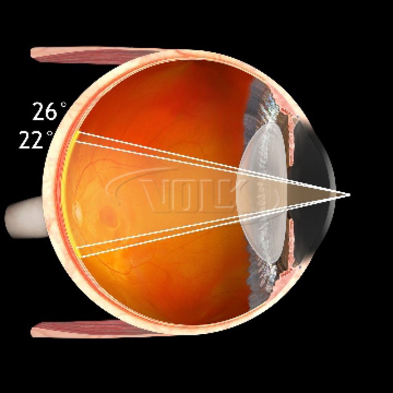 Volk VCD Centralis Direct Lens (New Design), with Black Ring, view 5