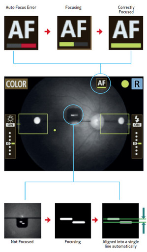 Canon CR-2 PLUS AF Digital Non-Mydriatic Retinal Camera