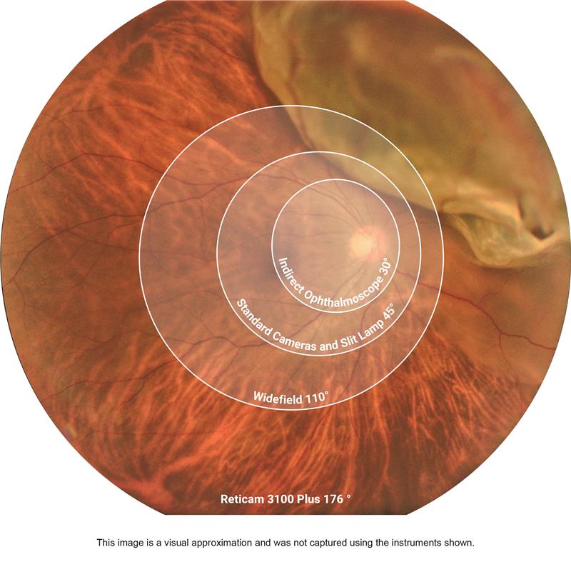 Marco Reticam 3100 Plus Ultra-Widefield Fundus Camera, view 6