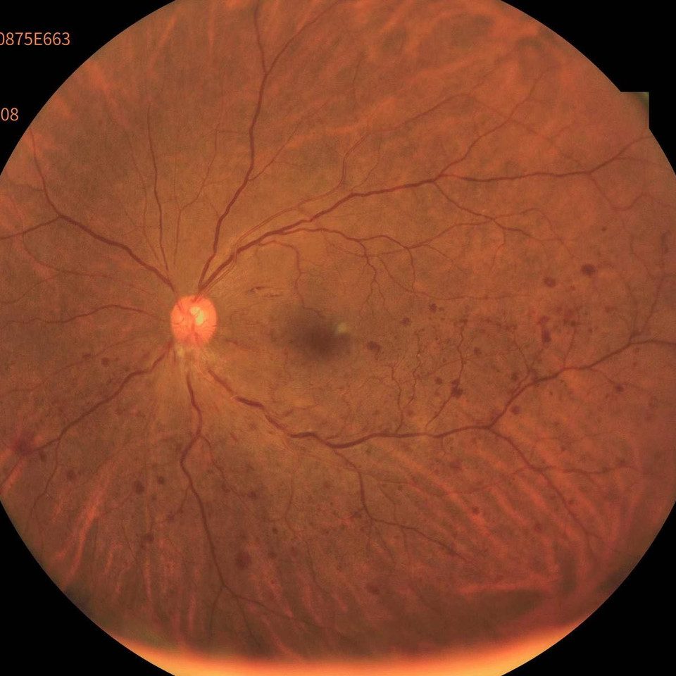 Marco Reticam 3100 Plus Ultra-Widefield Fundus Camera, view 4