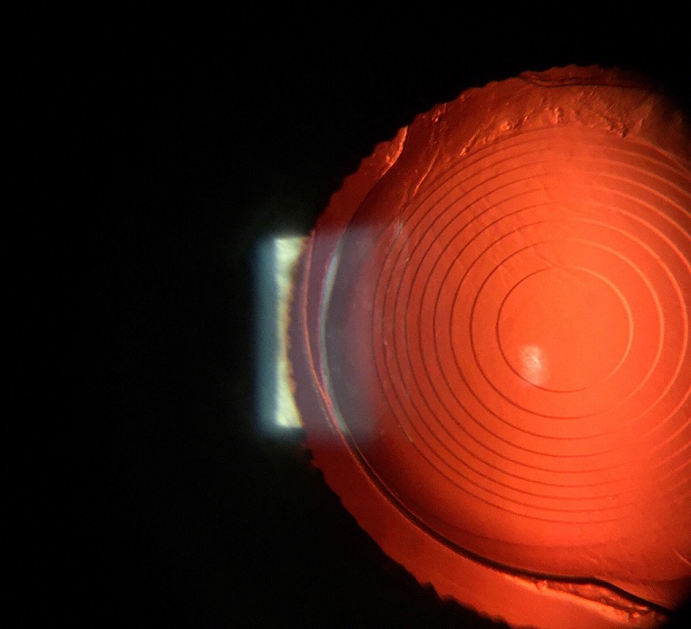 Marco iON 2 Imaging System, view 7