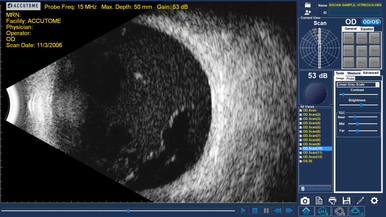 Keeler B-Scan Plus, view 5