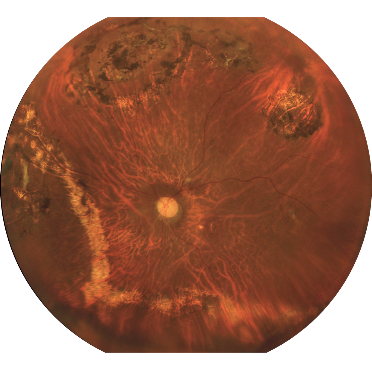 Marco Reticam 3100 Plus Ultra-Widefield Fundus Camera, view 3