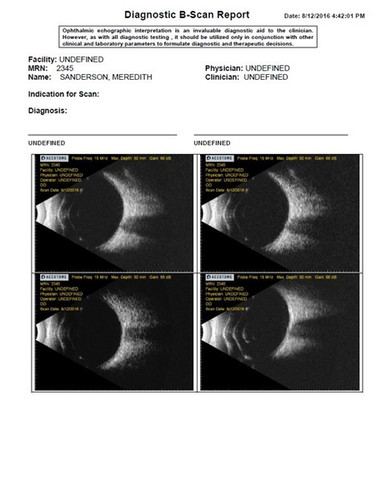 Keeler B-Scan Plus, view 6