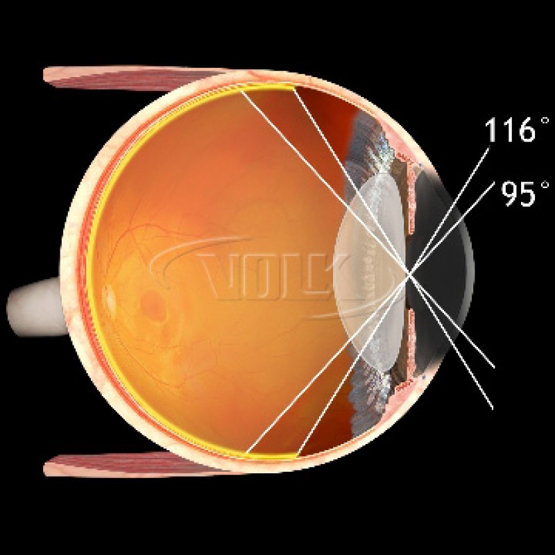 Volk VSFNC SuperField NC Lens, with Black Ring, view 3