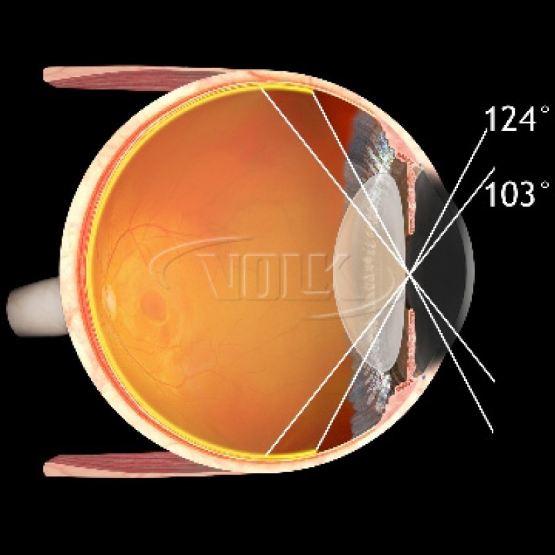 Volk Super Pupil XL Lens, view 5