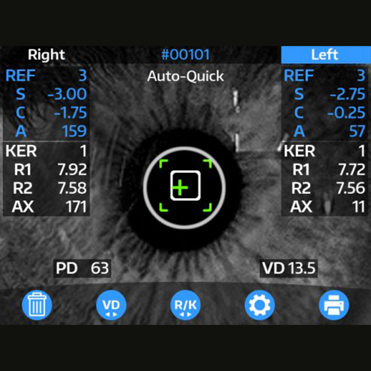 Reichert OptoChek Plus Autorefractor/Keratometer (Pre-Owned), view 6