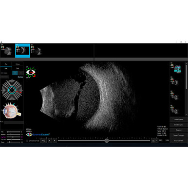 Sonomed VuPad Portable Ultrasound, view 9