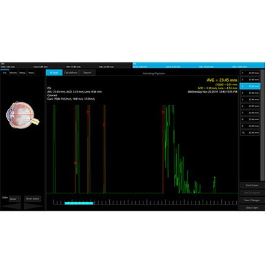Sonomed VuPad Portable Ultrasound, view 6