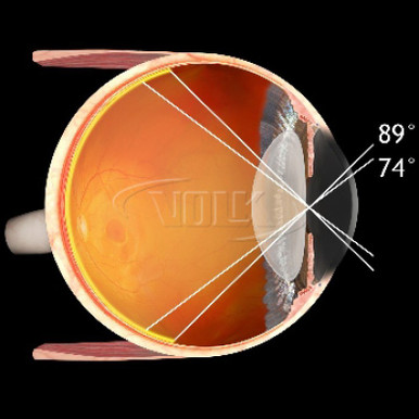 Volk 90D Small Aspheric Lens, Clear, with Red Ring